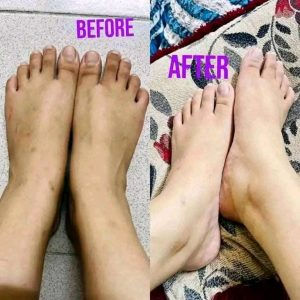 Gluta-collagen-pink-review-3